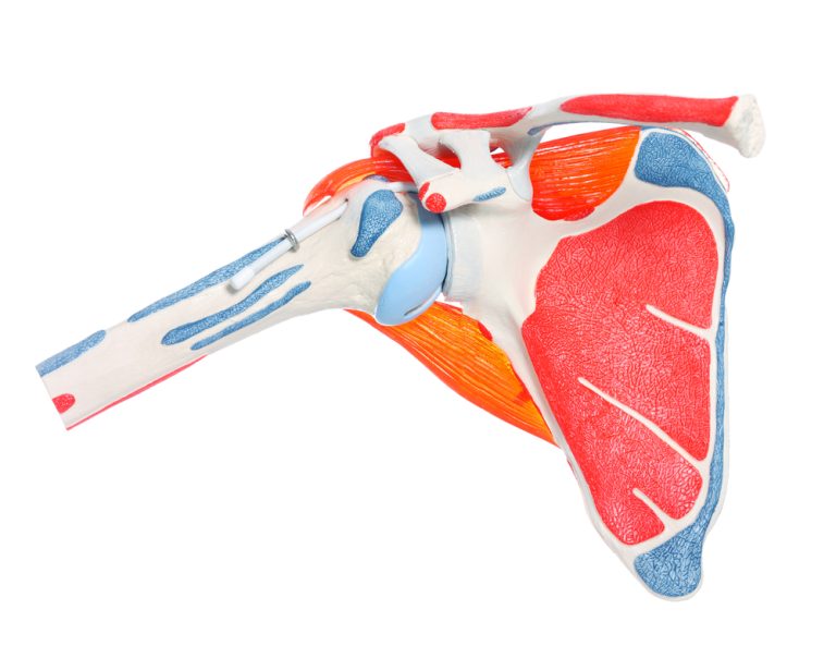10-11-Scapulaire positionering is te verbeteren met EMG-biofeedback training_65421685 10-11-Scapulaire positionering is te verbeteren met EMG-biofeedback training_65421685