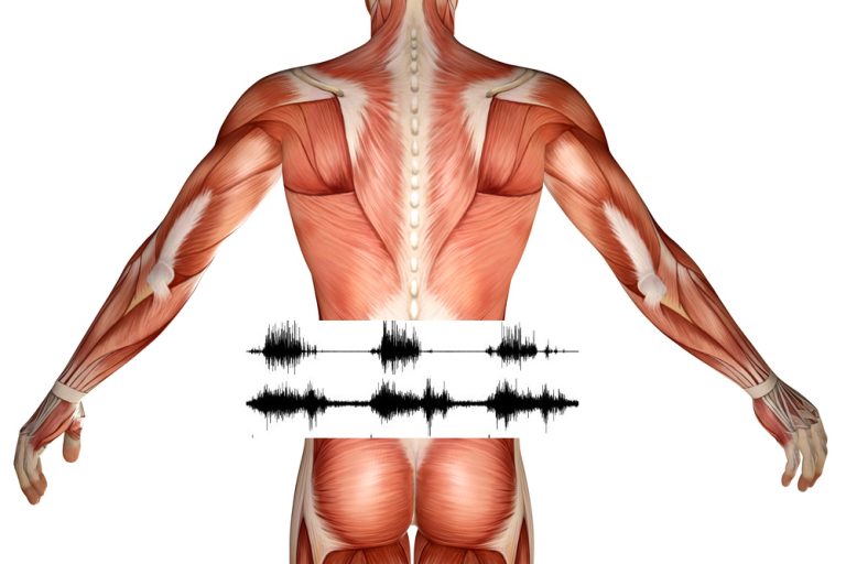 11-17-Fysiotherapie bij rugpijn uitbreiden met EMG-biofeedback_470591129 11-17-Fysiotherapie bij rugpijn uitbreiden met EMG-biofeedback_470591129