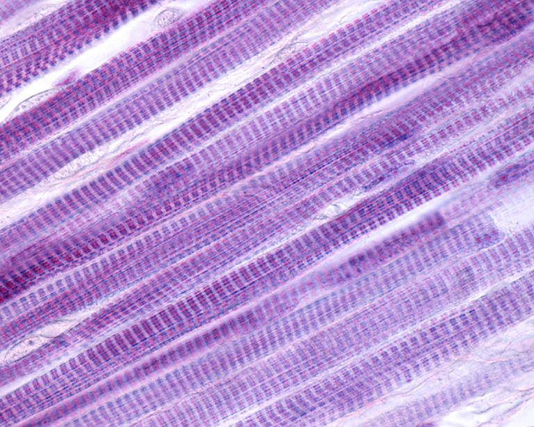 12-19-Trainingseffecten op moleculair niveau_1042870201 Dwarsgestreept spierweefsel onder de microscoop.