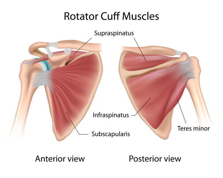 15-01-Mulligan mobilisaties bij het rotator cuff syndroom_147943874