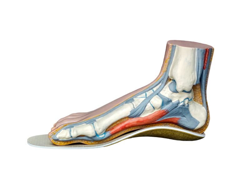 Foot fotomodel on a shoe insert