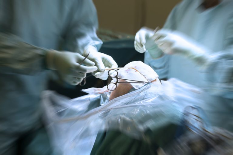 A surgical team is preparing a hamstring tendon graft for ligament reconstruction of the (human) knee. Shallow depth of field with focus placed over the graft that is prepared by adding whipstitches in both ends (of the graft). Blurred background.