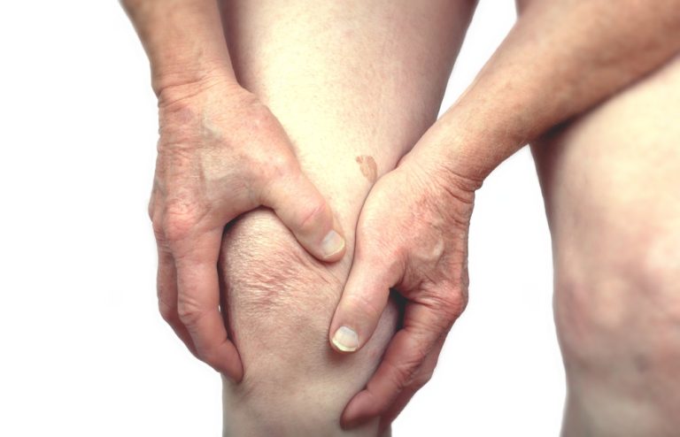 7_04_2_artrose-knie-pijncoping_89553295 7_04_2_artrose-knie-pijncoping_89553295