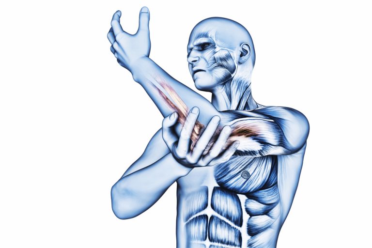 8-18-Ook-zonder-nekklachten-vaak-cervicale-dysfunctie-bij-epicondylitis_161258453 8-18-Ook-zonder-nekklachten-vaak-cervicale-dysfunctie-bij-epicondylitis_161258453