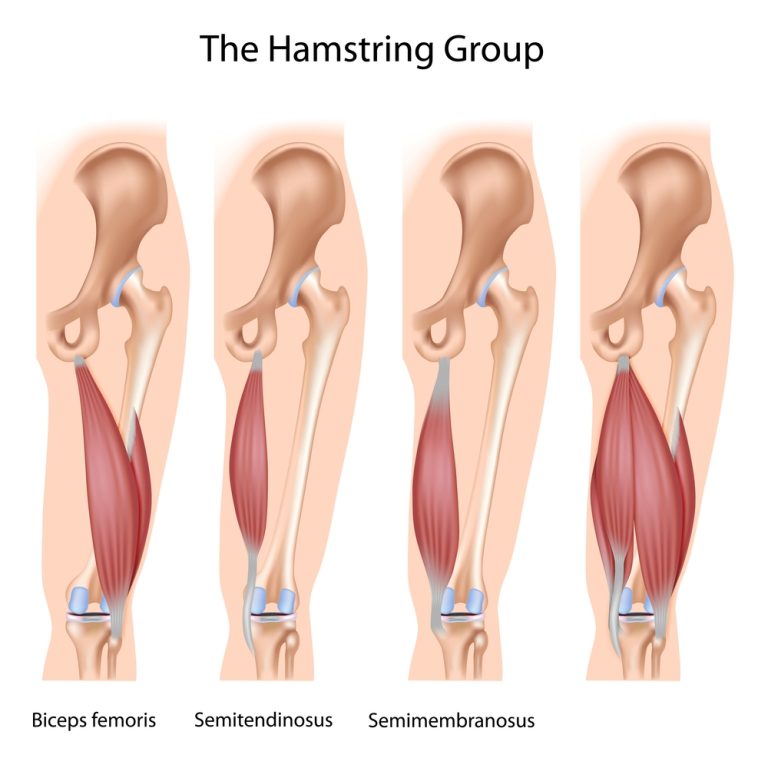 9-01-Coördinatie hamstringspieren van belang voor blessure preventie-157672217 9-01-Coördinatie hamstringspieren van belang voor blessure preventie-157672217