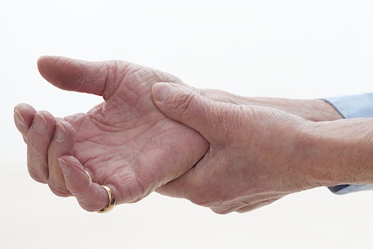 9-02-Onduidelijkheid over beste fysiotherapeutische behandeling bij artrose duim_174271697 9-02-Onduidelijkheid over beste fysiotherapeutische behandeling bij artrose duim_174271697
