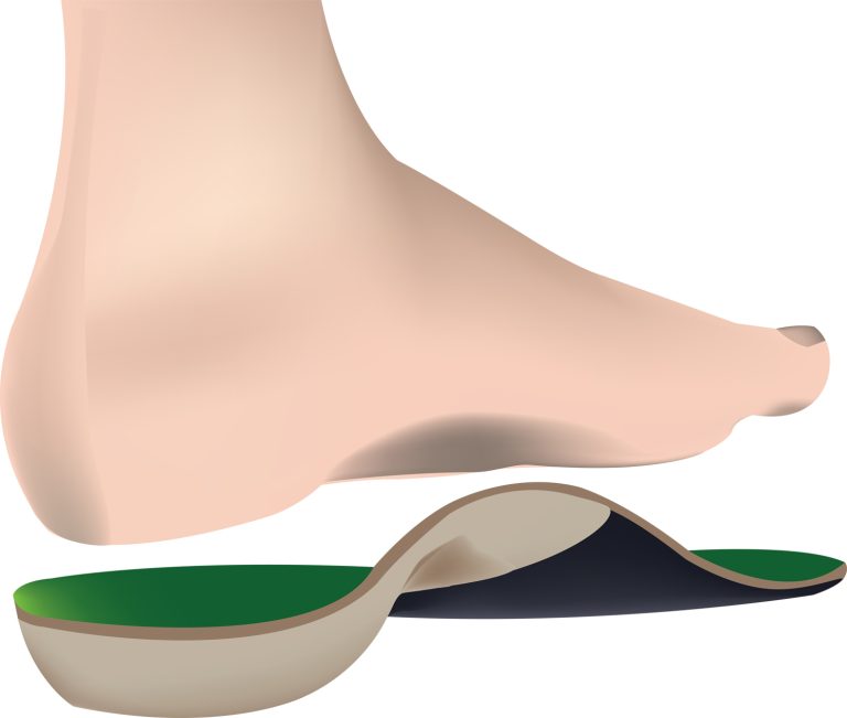 9-09-Helpen schoenen met anatomische inlegzolen bij voorkomen shin splints-shutterstock-b_195545564