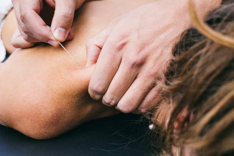 9-13-Dry needling en muscle energy techniques succesvolle combinatie bij nekpijn_317136938 9-13-Dry needling en muscle energy techniques succesvolle combinatie bij nekpijn_317136938