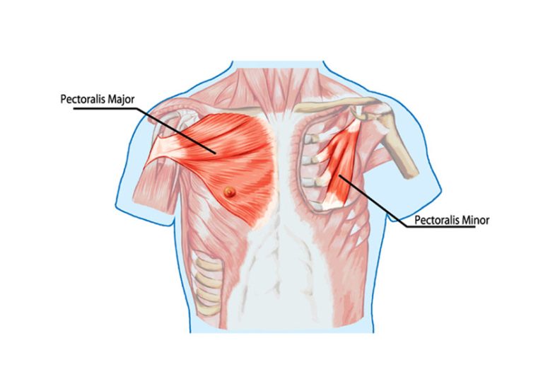 9-13-Rekken van m. pectoralis minor vermindert disbalans schoudergordel_129969773 9-13-Rekken van m. pectoralis minor vermindert disbalans schoudergordel_129969773