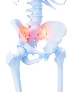 Illustratie van het SI-gewricht met focus op pijnlocatie en anatomie voor diagnostische testen