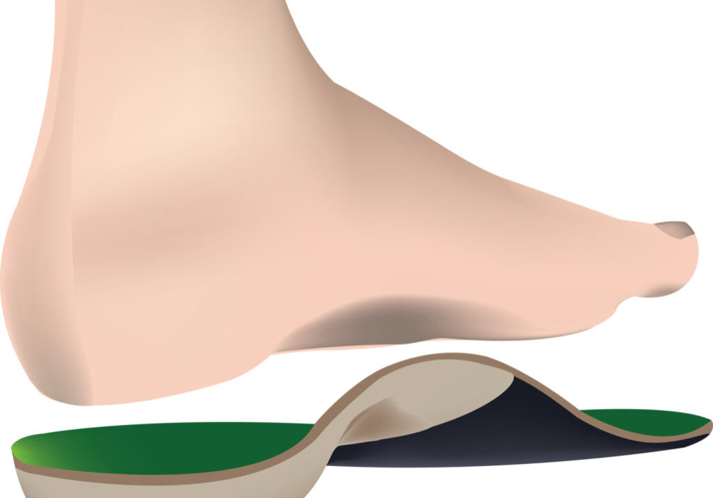9-09-Helpen schoenen met anatomische inlegzolen bij voorkomen shin splints-shutterstock-b_195545564